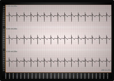 LightningChart WPF ecg-ekg-chart-millimeter-grid example