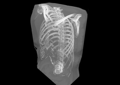 Arction volume-rendering-skeleton-1 example